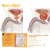 Hurbolism New update Cure Prostatitis Herbal Powder,Treat Prostatic Hyperplasia,Ease Kidney Urethral Pressure,Eliminate toxins